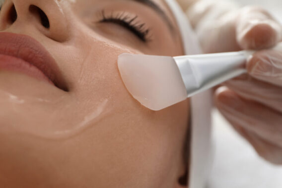 Is a Chemical Peel Safe for Sensitive Skin?