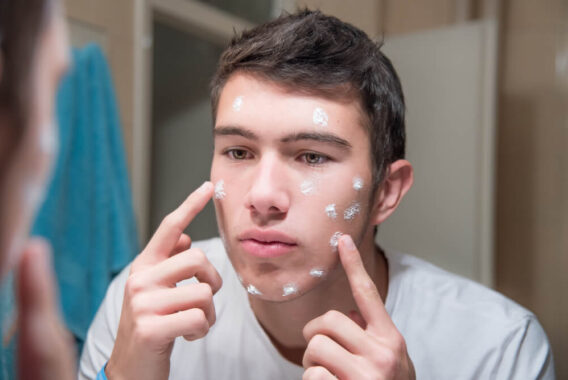 How Will a Dermatologist Help with My Acne Problem?