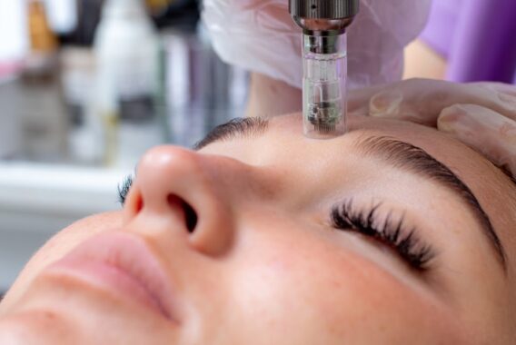 Microneedling and Anti-Aging. Why You’ll Love It