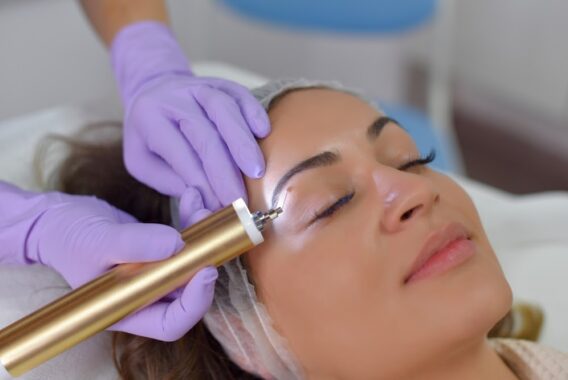 Why a Cosmetic Mole Removal Is Right for You