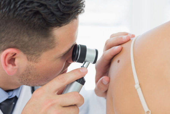 What Are the Symptoms of Skin Cancer?
