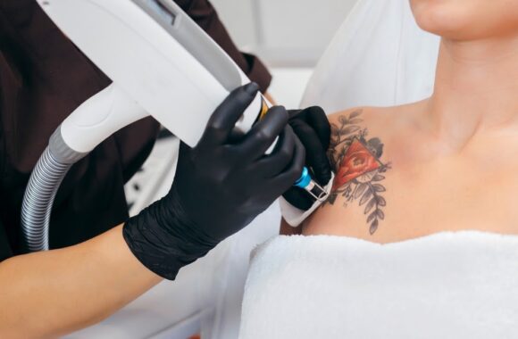 Why Fall Is the Perfect Time to Begin Tattoo Removal
