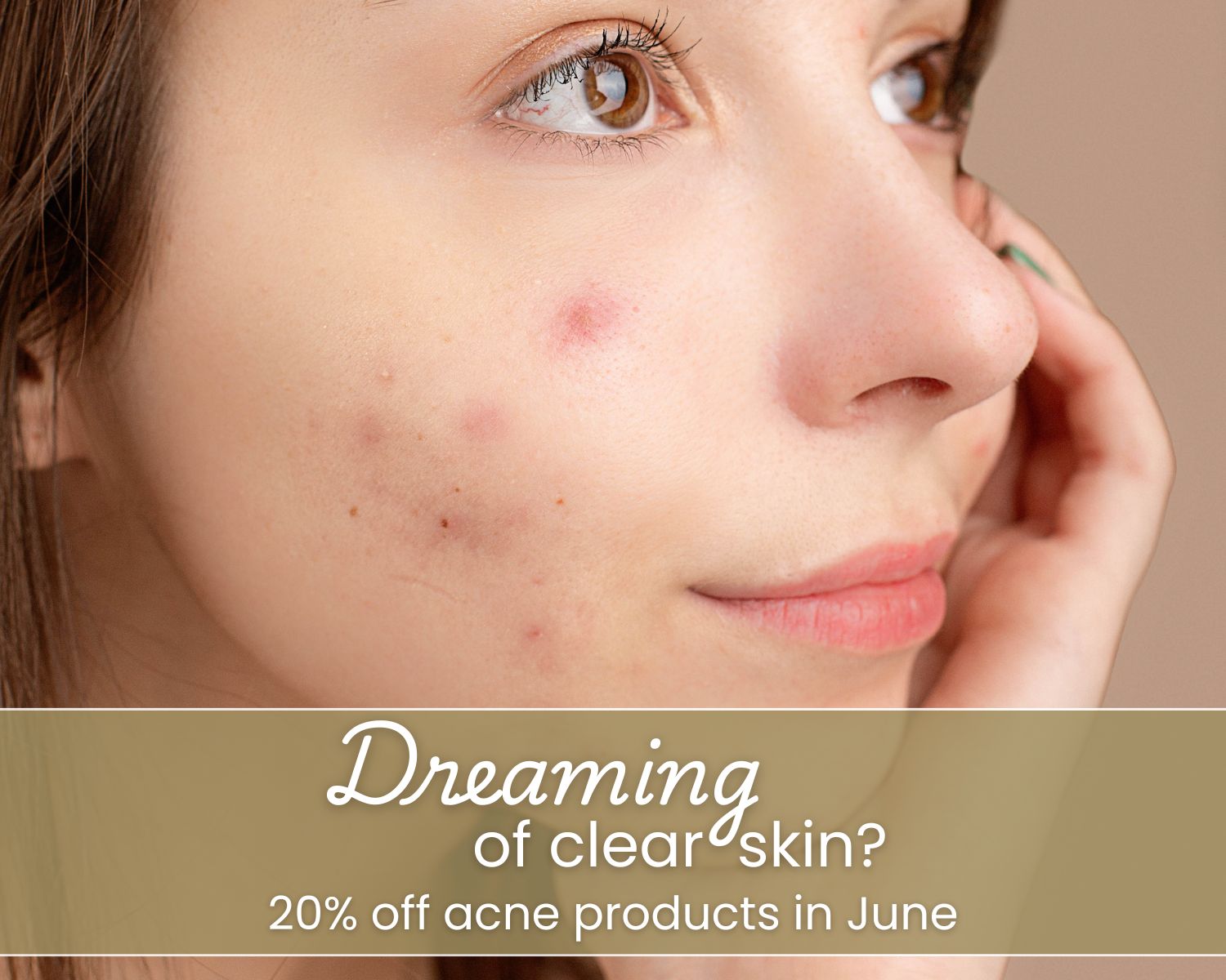 LA Derm 20 off acne product sunscreen June 2025 WEB 1 - LA Dermatology | Dermatology About Flexile Classic