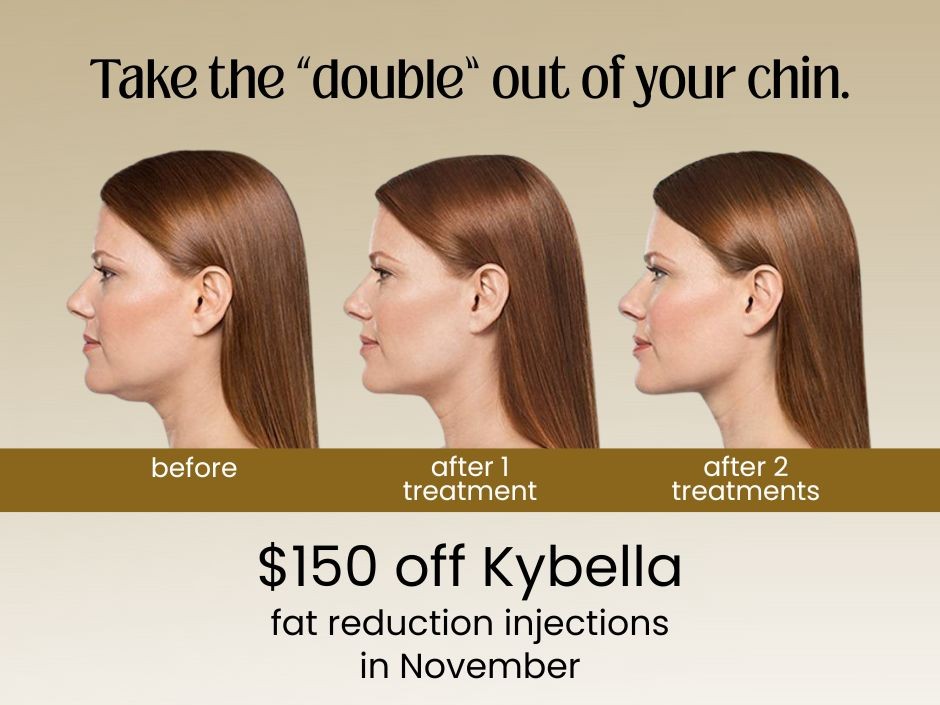 About Flexile Classic